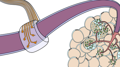 The image shows a flexible electrode that is connected to a nerve. The nerve is represented as a purple colored tube. The electrode consists of six circular metal parts each equipped with a small tip that goes into the nerve. A metallic conducting track leads to any of these electrode ends. The tracks are embedded in a transparent band. 