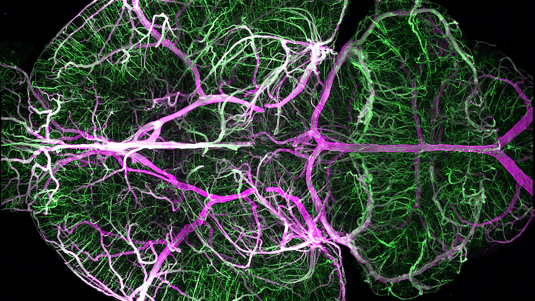  Image of the complete brain vasculature of a mouse created using high-resolution fluorescent microscopy. 