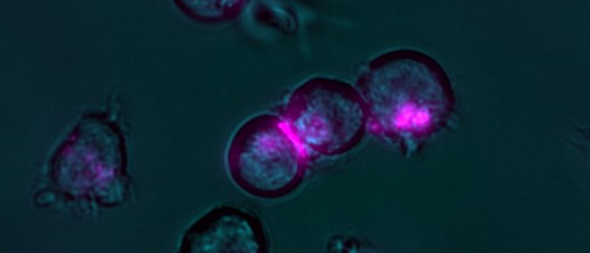 Cell cluster and fluorescent (red) nano switches. Image: Benjamin Kick, Klaus Wagenbauer, Jonas Funke / TUM