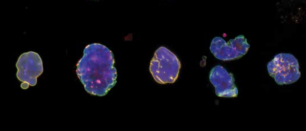 Nuclei of HGPS cells