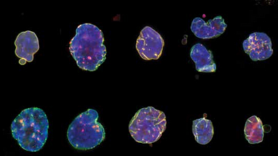 Nuclei of HGPS cells