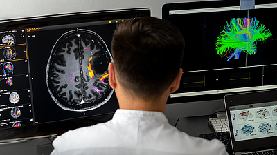 Gliom Connectom Analysis: die Arbeitsgruppe funktionelle Neuronavigation und -monotoring von Prof. Dr. med. Sandro Krieg an der Neurochirurgischen Klinik der TUM am Klinikum rechts der Isar kartiert präoperativ den Bereich der Bewegungs- und Spracharele mittels navigierter transkranieller Magnetsimulation (nTMS), um diese Bereiche bei einer Operation eines Hirntumors (Gliom) zu schonen. Bild: Astrid Eckert / TUM