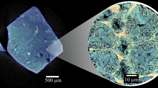 Microscopic (left) and high-resolution intracellular iodine distribution (right) in murine kidney enable the localization of the contrast agent.Image: Kirsten Taphorn / TUM.