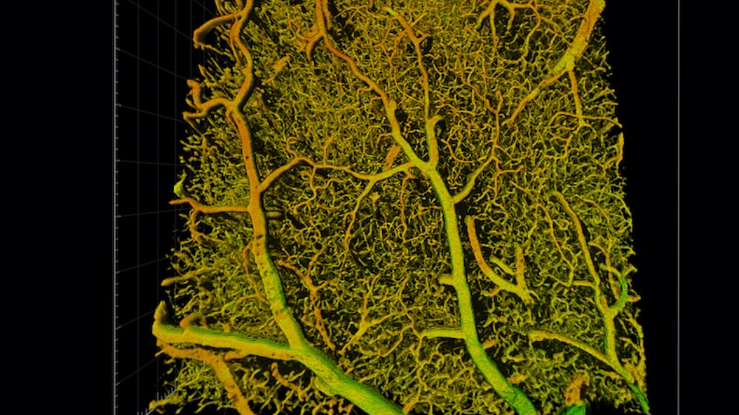 Detail of the brain vasculature of a mouse reconstructed using deep learning. Detail of the brain vasculature of a mouse reconstructed using deep learning. Detail of the brain vasculature of a mouse reconstructed using deep learning.