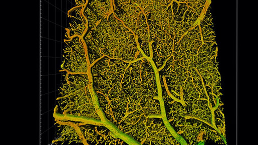  Detail of the brain vasculature of a mouse reconstructed using deep learning. Detail of the brain vasculature of a mouse reconstructed using deep learning.