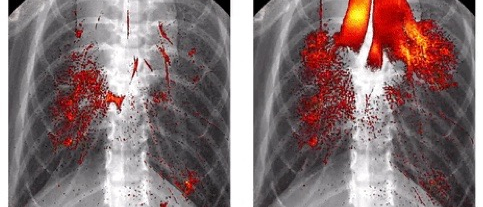 Distribution of a drug in the lung of a mouse at two different times after instillation. 