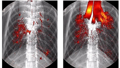 Distribution of a drug in the lung of a mouse at two different times after instillation. 