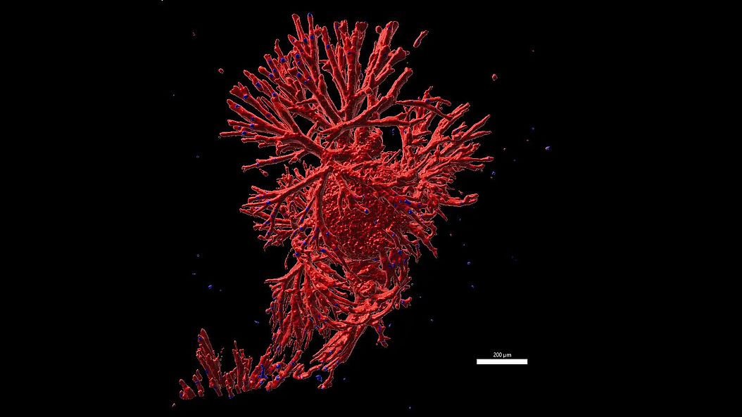 Star-like tumor-organoid with a circular cone and multiple invasive branches. Image: Aris Papargyriou / TUM
