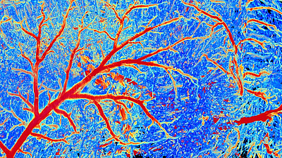 Detail of the brain vasculature of a mouse. 
