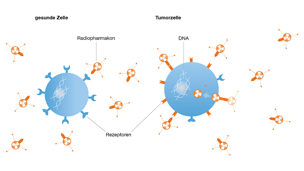 Die Grafik erklärt das Wirkungsprinzip von Radiopharmak in der Therapie. 