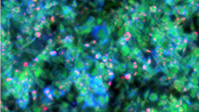 MiROM micrograph of living adipocytes 