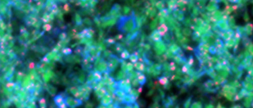 MiROM micrograph of living adipocytes 