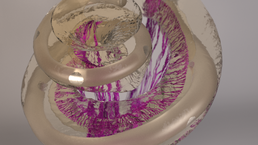 3D image of the human inner ear with an inserted cochlear implant electrode, reconstructed from a high-resolution computer tomography. The reconstructed auditory nerve fibers running from the cochlea through the bone all the way to the brain are shown in purple. Image: Siwei Bai / TUM