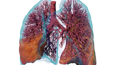 Digital twin of a human lung. Image: Jakob Richter / Ebenbuild