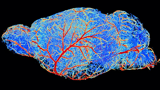  Reconstruction of the brain vasculature of a mouse created using artificial intelligence. 