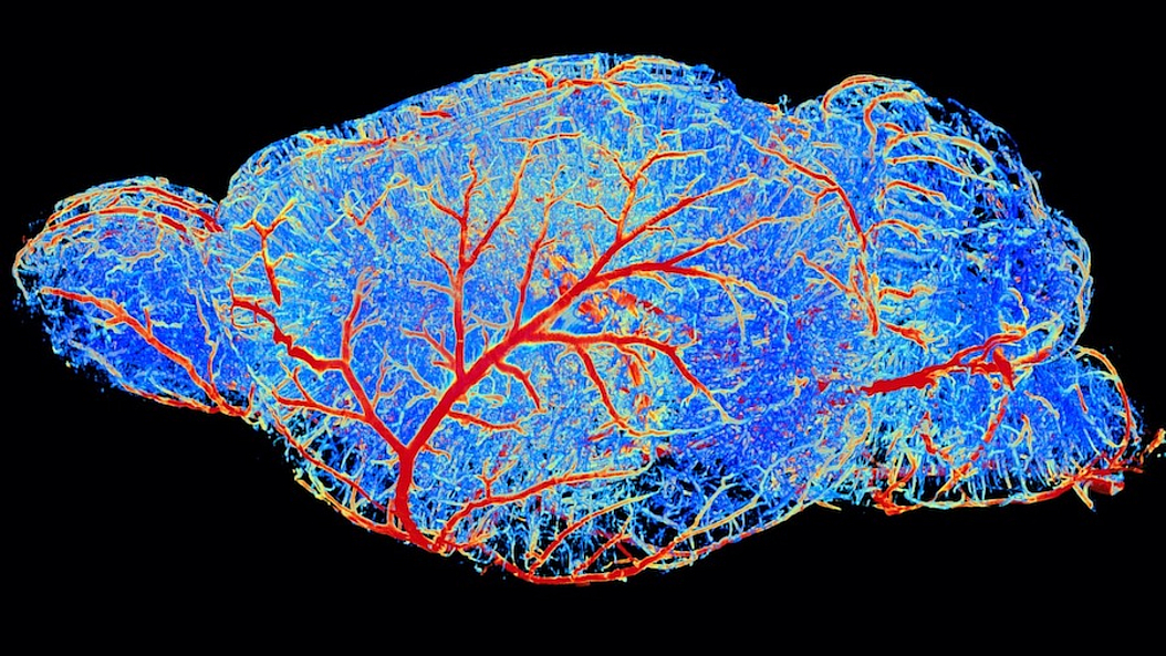 Reconstruction of the brain vasculature of a mouse created using artificial intelligence. Reconstruction of the brain vasculature of a mouse created using artificial intelligence.