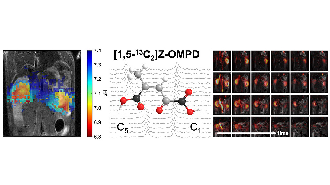 Z-OMPD was discovered as a new molecular sensor for hyperpolarized 13C MRI