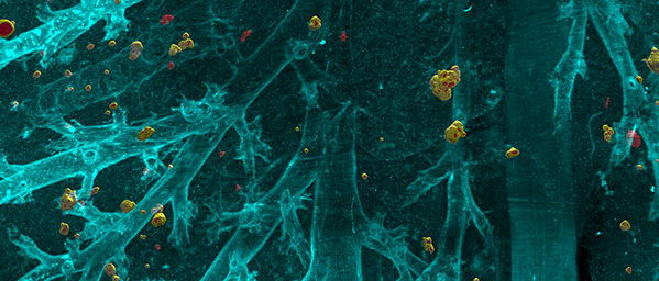 DeepMACT makes use of artificial intelligence to find even the smallest metastases in the entire mouse body. The picture shows single disseminated cells spreading though the lung. (Image: Helmholtz Zentrum München)