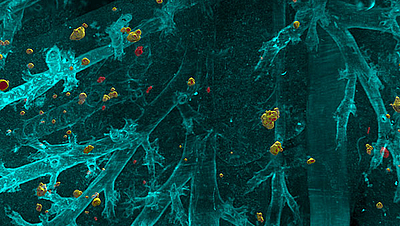 DeepMACT makes use of artificial intelligence to find even the smallest metastases in the entire mouse body. The picture shows single disseminated cells spreading though the lung. (Image: Helmholtz Zentrum München)