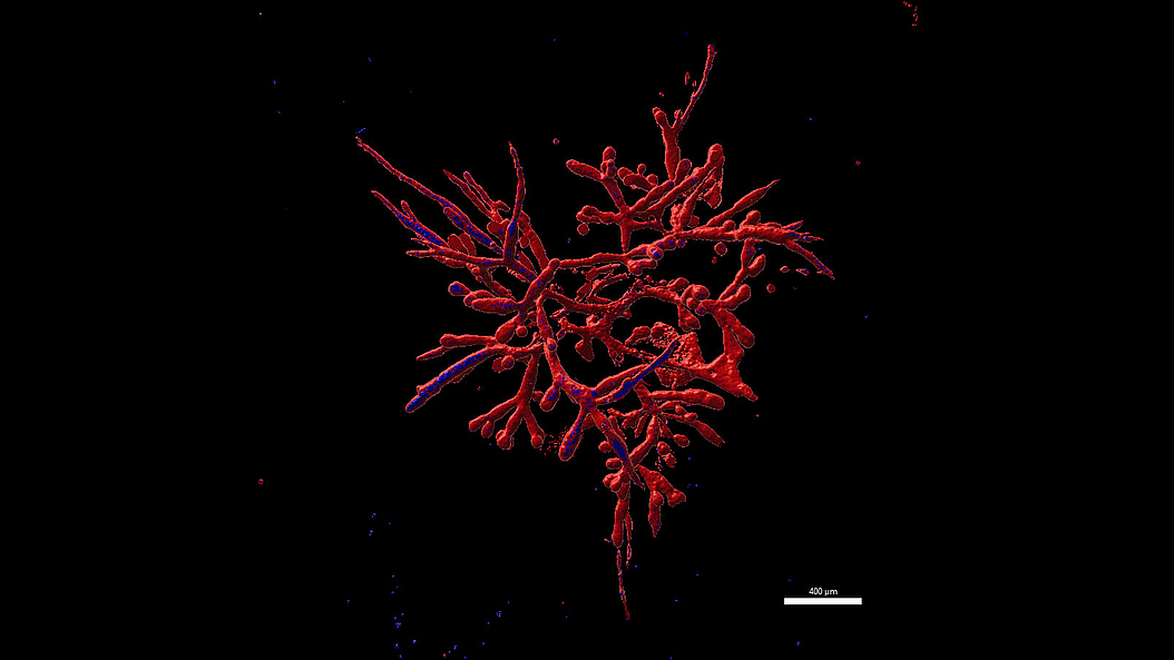 Pancreatic tumor organoid from the phenotype ‟TEBBO”. Image: Aris Papargyriou / TUM