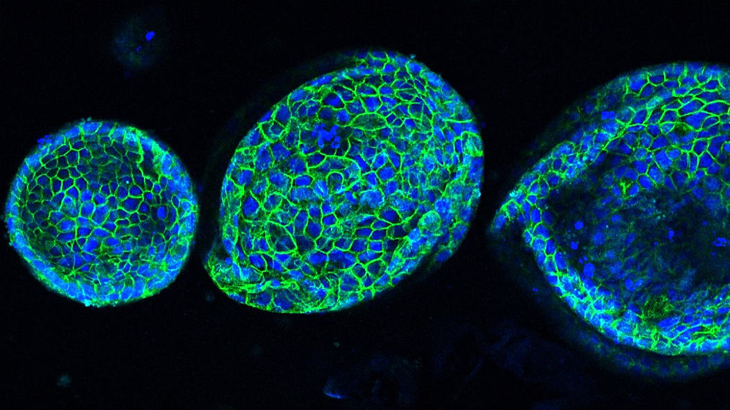 Classic, spheric pancreatic cancer organoids. Image: Aris Papargyriou / TUM