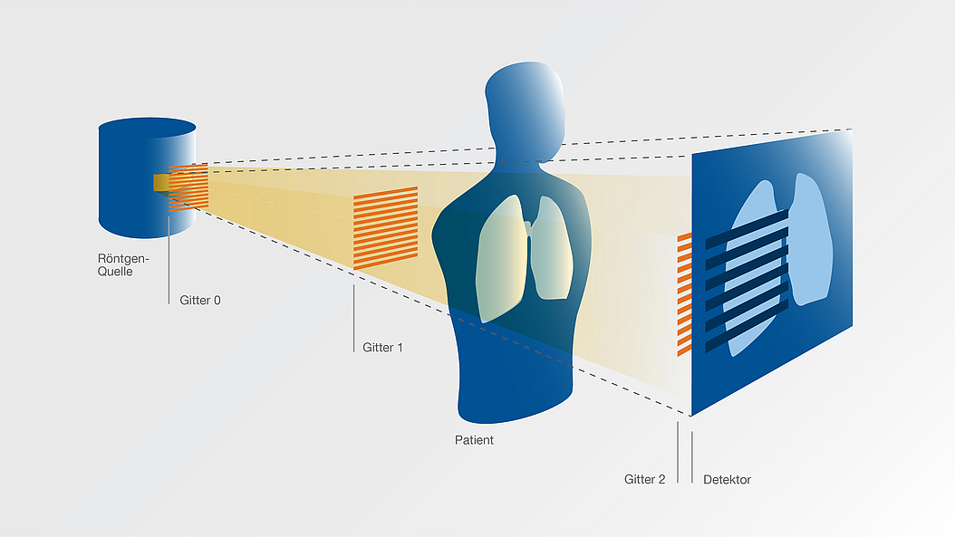 Schematic of a device for x-ray dark field imaging. Schematic of a device for x-ray dark field imaging.