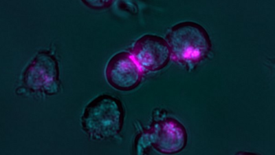 Cell cluster and fluorescent (red) nano switches. Image: Benjamin Kick, Klaus Wagenbauer, Jonas Funke / TUM