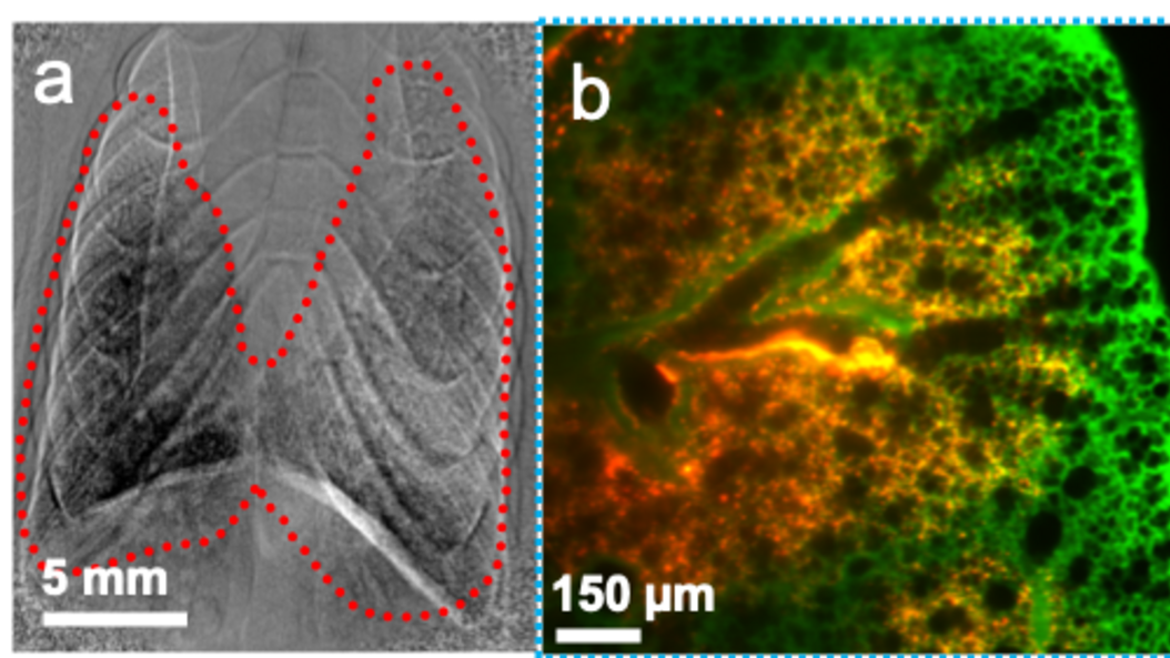 Examples of images showing how drugs would be distributed in the lung of a mouse after instillation.