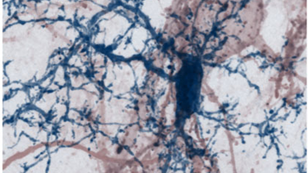 A nerve cell with its dendritic processes studded by synaptic spines (red) being contacted by brain-resident microglia cell (blue) in a mouse brain. Image: T. Misgeld, M. Kerschensteiner