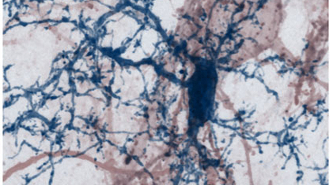 A nerve cell with its dendritic processes studded by synaptic spines (red) being contacted by brain-resident microglia cell (blue) in a mouse brain. Image: T. Misgeld, M. Kerschensteiner A nerve cell with its dendritic processes studded by synaptic spines (red) being contacted by brain-resident microglia cell (blue) in a mouse brain. Image: T. Misgeld, M. Kerschensteiner