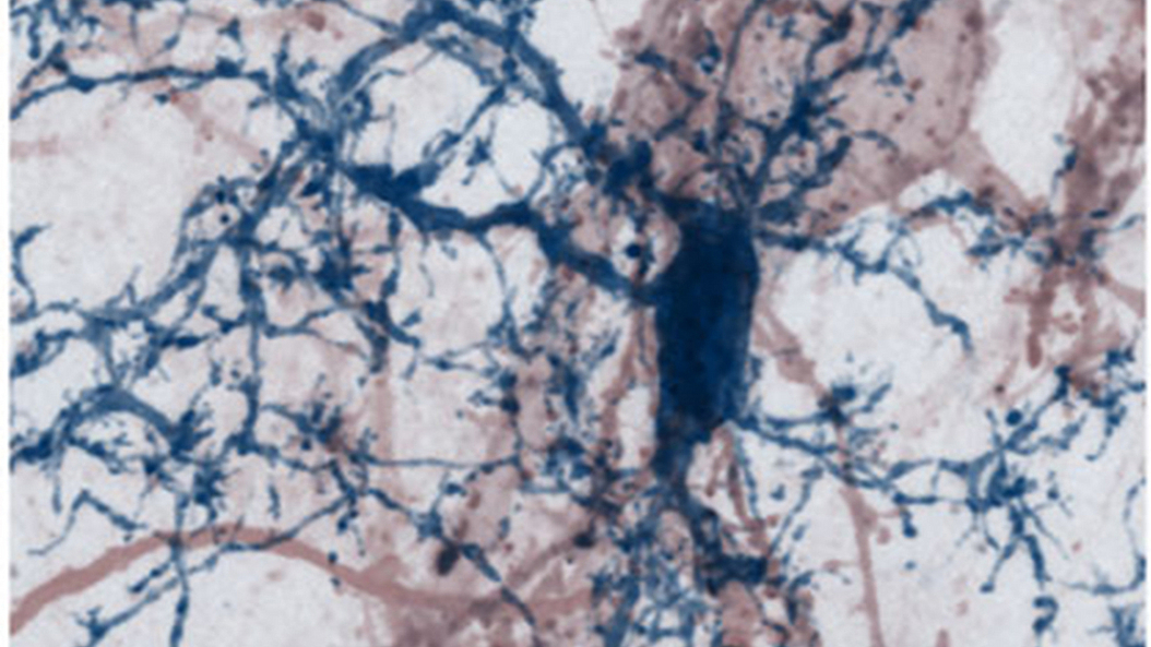 Kontakte einer Mikrogliazelle (blau) mit einer Nervenzelle und ihren dendritischen Fortsätzen (rot) im Mausgehirn. Bild: T. Misgeld, M. Kerschensteiner